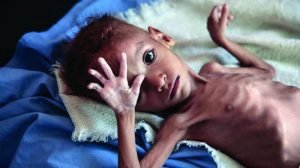 What causes malnutrition?